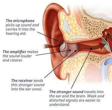 How Do Hearing Aids Work - How Do Hearing Aids Work