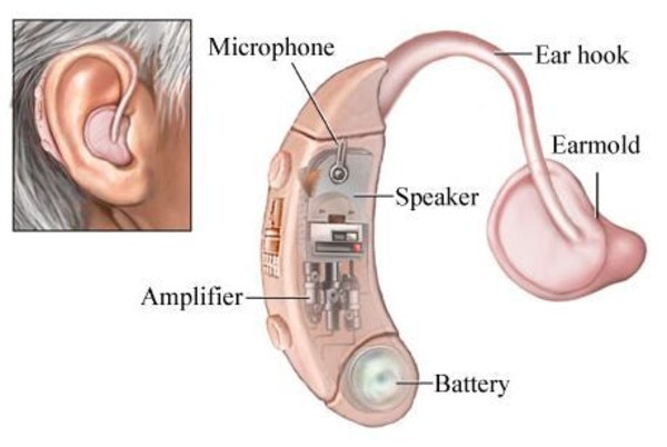 How Do Hearing Aids Work - What Are the Parts of a Hearing Aid