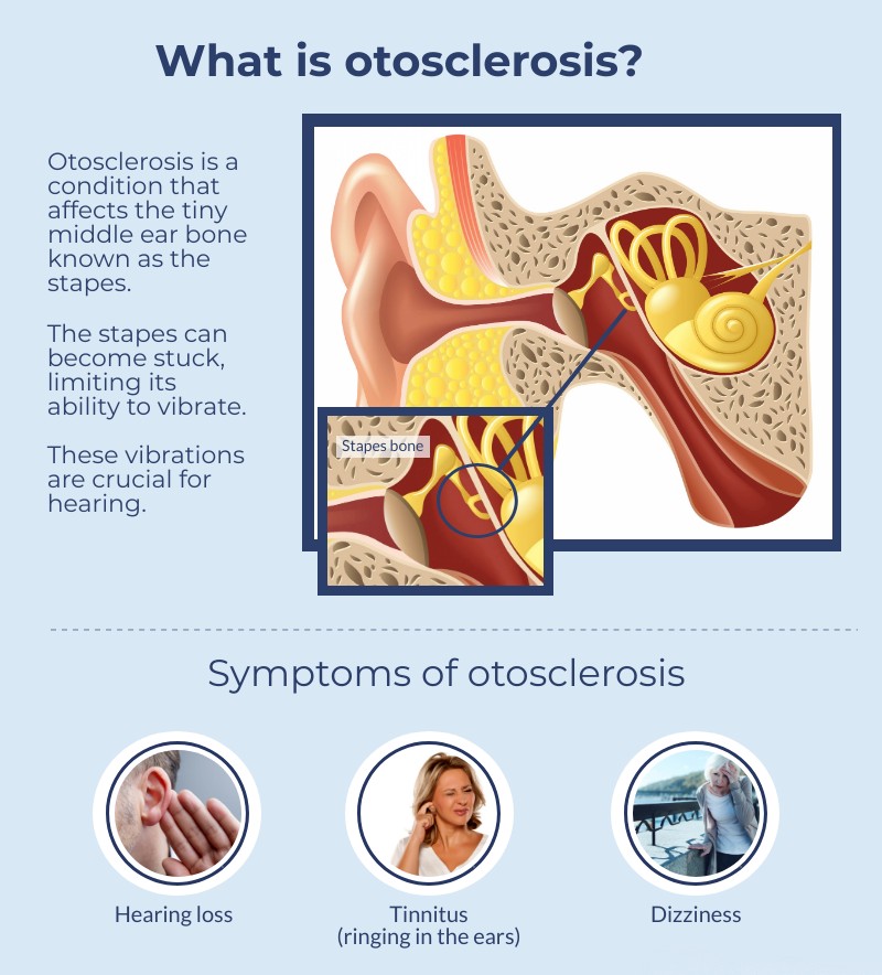 What is osteosclerosis